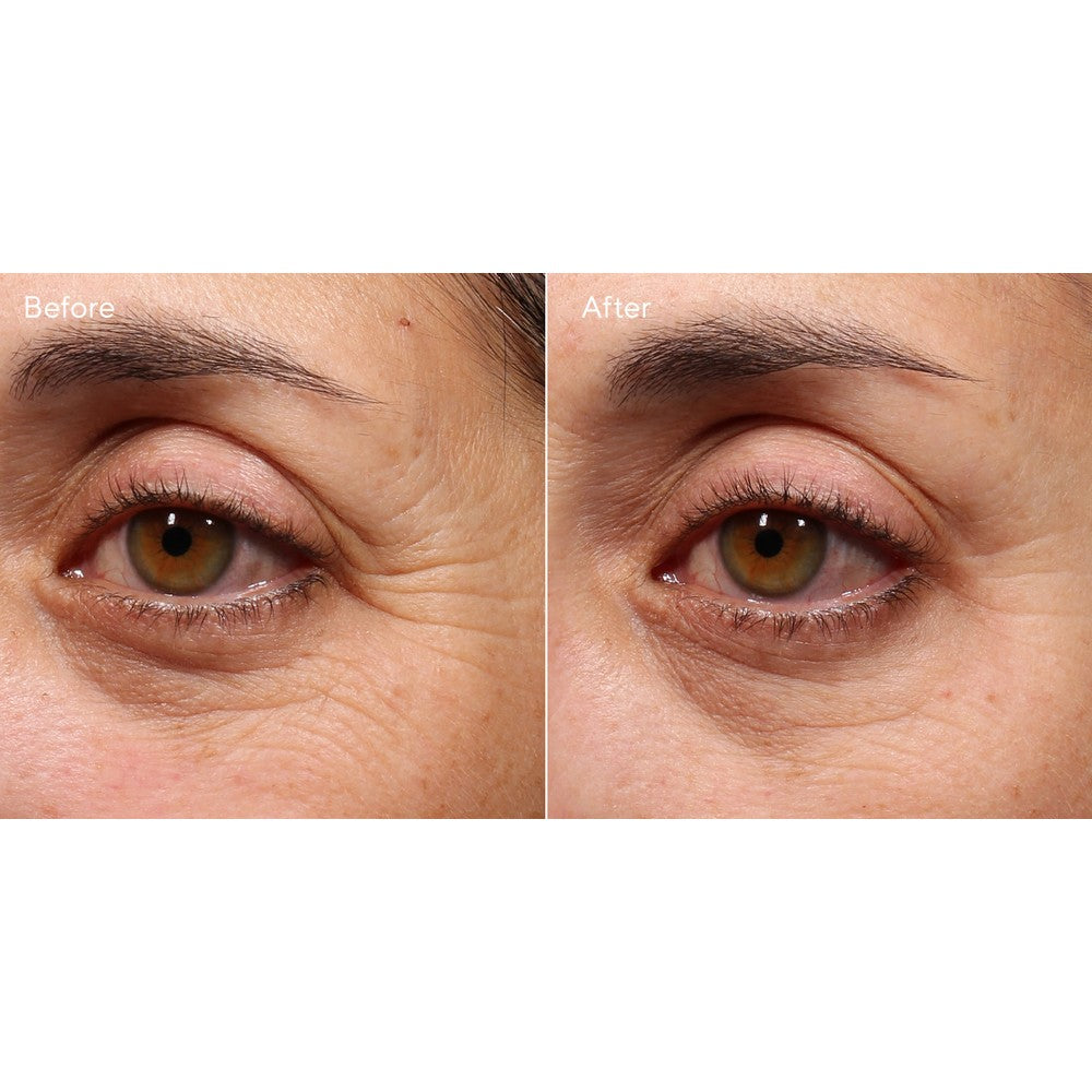 Retinol Youth Renewal Eye Serum - 15 ML